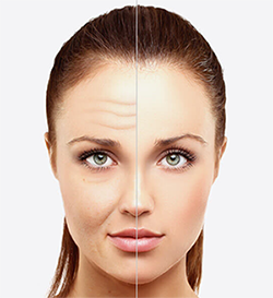 Anti Aging Anti Aging