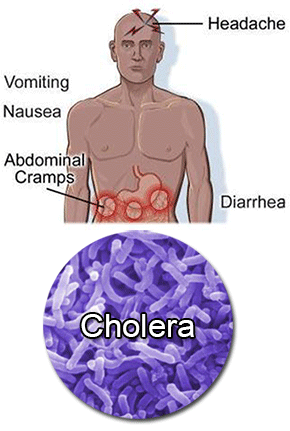 Cholera Cholera