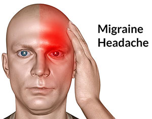 Migraine Migraine