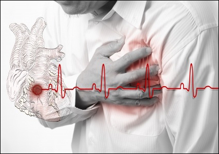 Angina Pectoris Angina Pectoris