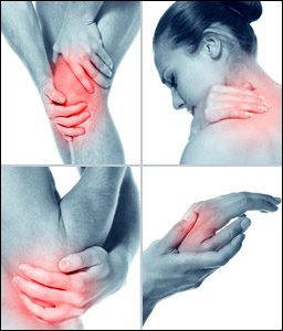 Arthritis Arthritis