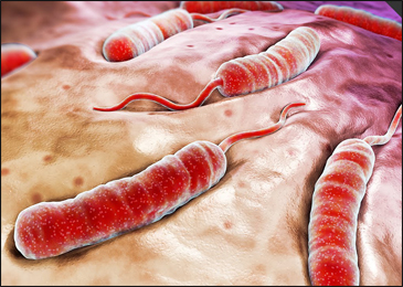 Cholera Cholera