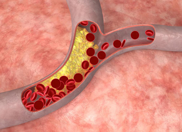 Cholesterol Cholesterol