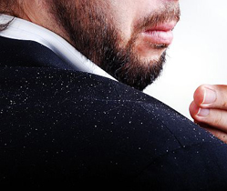 Dandruff Dandruff