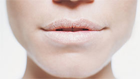 Dry Mouth Dry Mouth