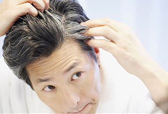 Premature Graying of Hair Premature Graying of Hair