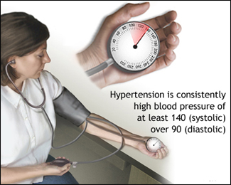Hypertension (High Blood Pressure) Hypertension (High Blood Pressure)