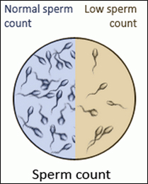 Low Sperm Count Low Sperm Count