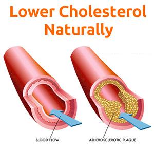 Lower Cholesterol Lower Cholesterol