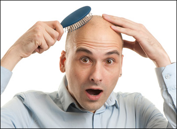 Baldness Baldness