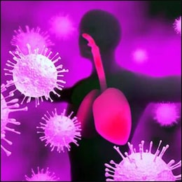Pneumonia Pneumonia