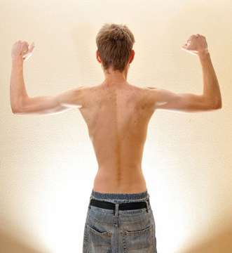 Underweight Man Underweight Man