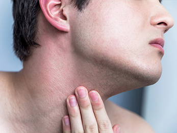 Linear Morphea Linear Morphea