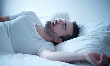 Sleep Apnea Sleep Apnea