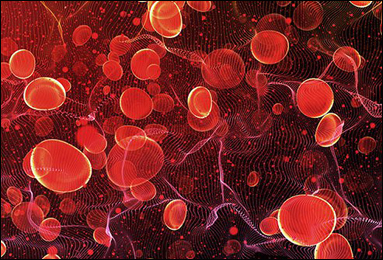 Hyponatremia (Low Blood Sodium) Hyponatremia (Low Blood Sodium)