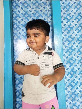 Before Rajamruth Vaidyashala Treatment