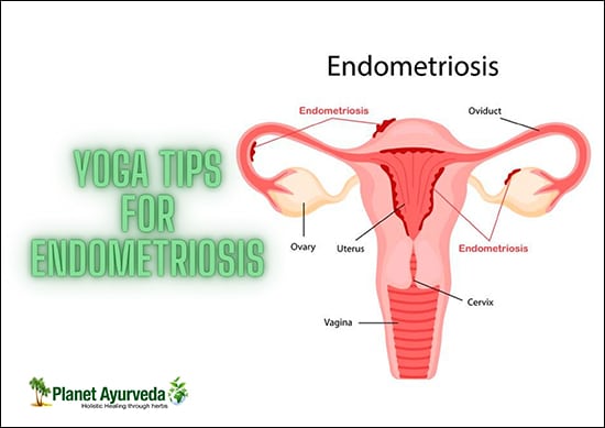 Yoga Tips For Endometriosis