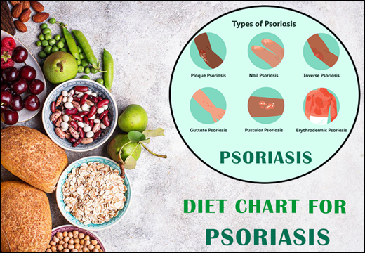 Diet Chart For Psoriasis Psoriasis, Diet Chart for Psoriasis, Diet Plan for Psoriasis, Psoriasis Diet Chart, Psoriasis Diet Plan, Rajamruth Vaidyashala Diet Chart, Rajamruth Vaidyashala Diet Chart For Psoriasis