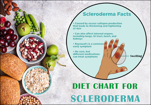 Diet Chart For Scleroderma Scleroderma, Diet Chart for Scleroderma, Diet Plan for Scleroderma, Scleroderma Diet Chart, Scleroderma Diet Plan, Rajamruth Vaidyashala Diet Chart, Rajamruth Vaidyashala Diet Chart For Scleroderma, Diet Chart For Scleroderma Patient